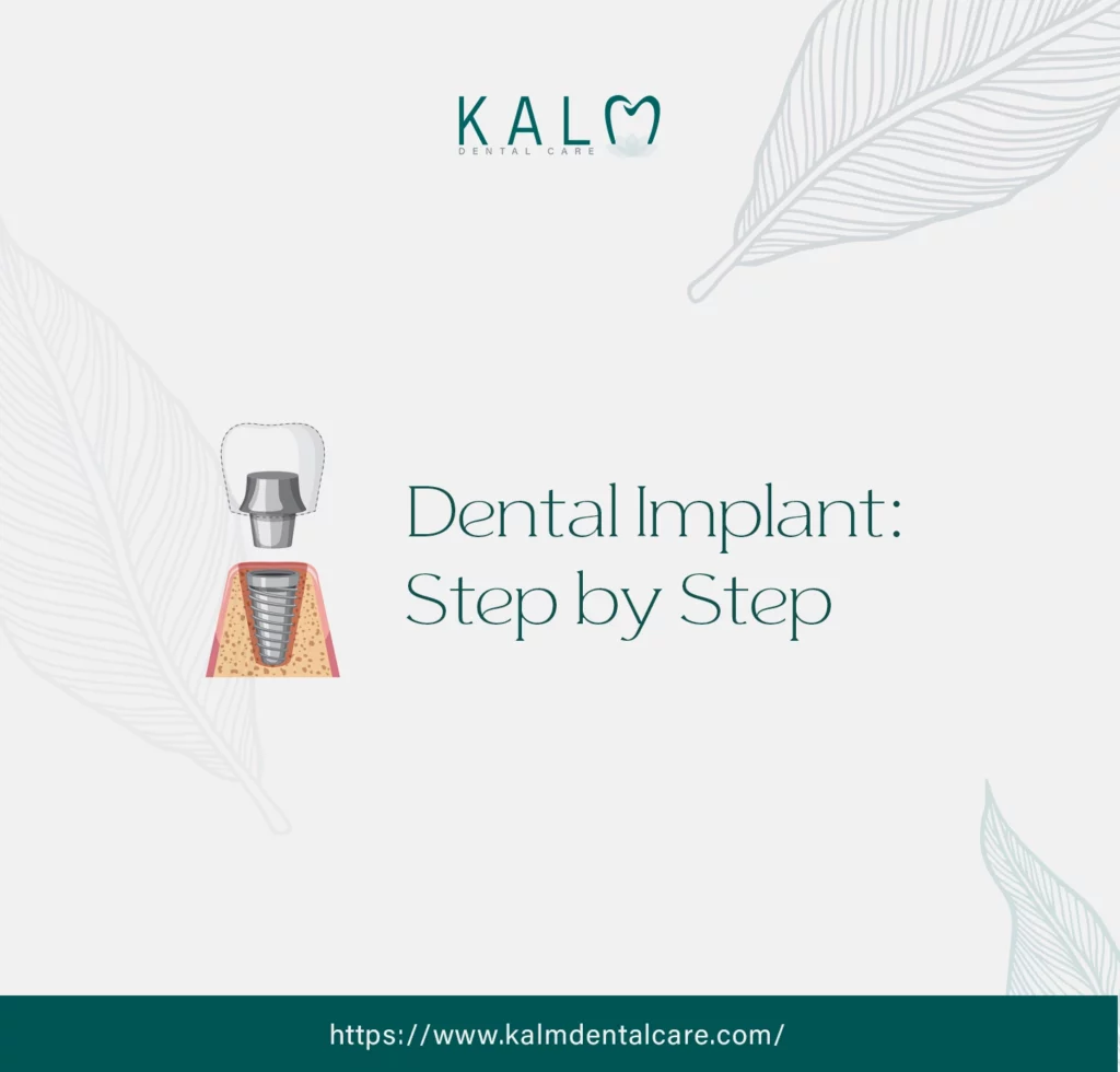 Dental Implant Healing Stages