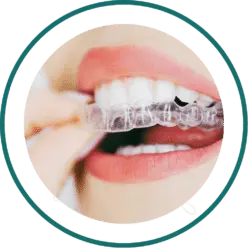 Bali dentist price list - Aligner | Kalm Dental Care