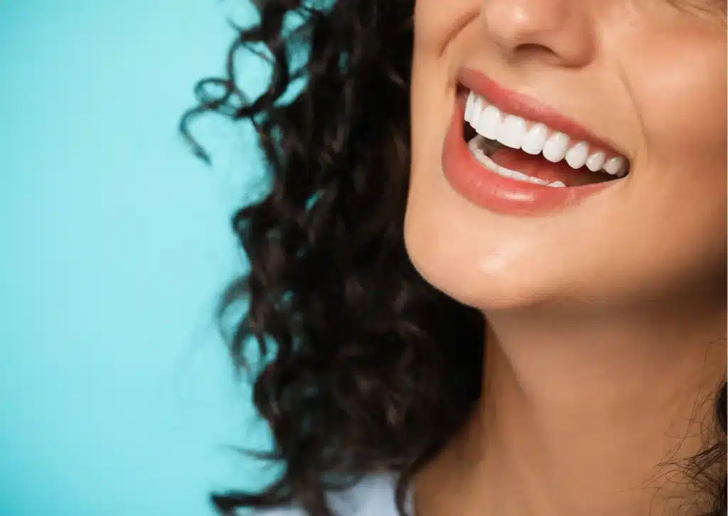 smile makeover