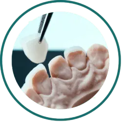 Dental Bali prices - Dental Veneers | kalm Dental Care