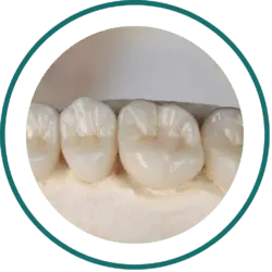 Bali dentist price list - Dental Crown | Kalm Dental Care