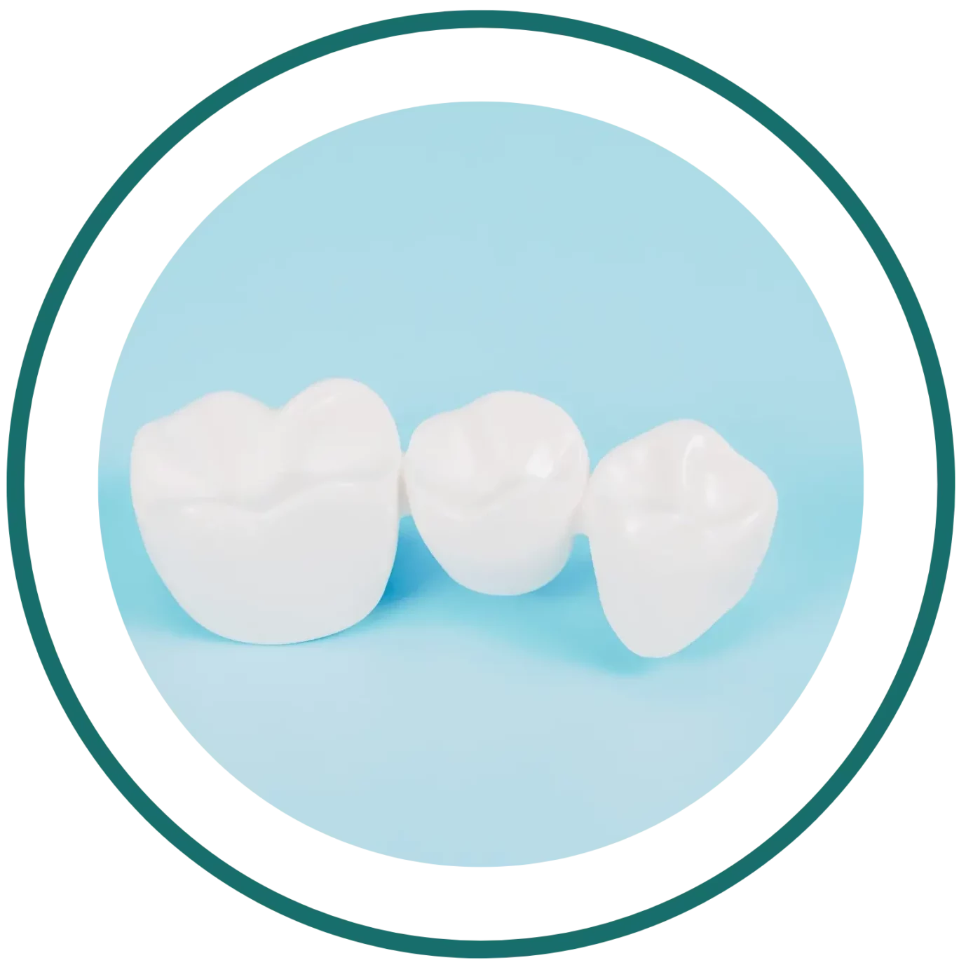 Dental Bali prices - Dental Bridge | kalm Dental Care