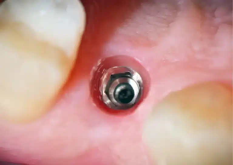 kalmdentalcare