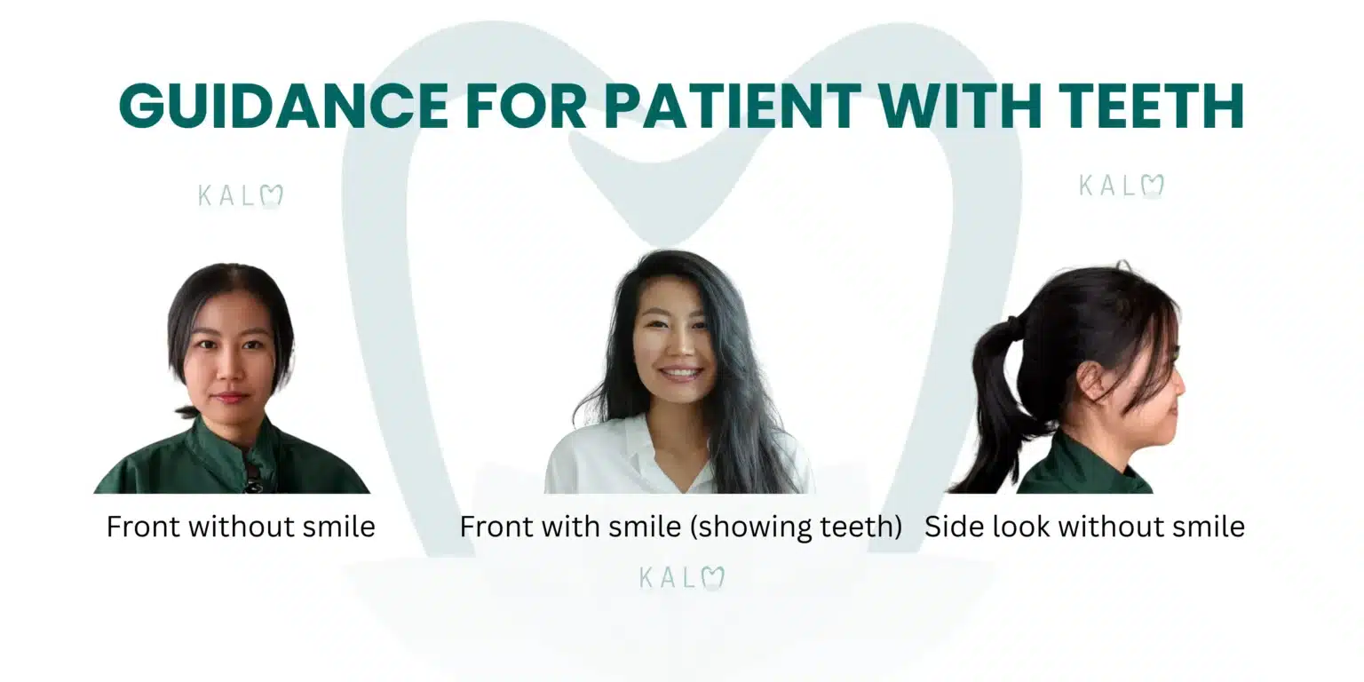 How to Take Clear Teeth Photos for Online Dental Consultation