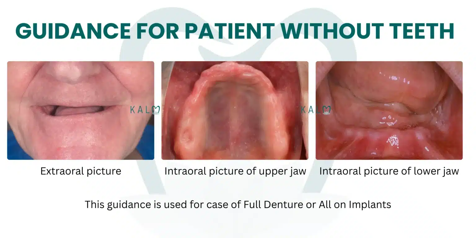 How to Take Clear Teeth Photos for Online Dental Consultation